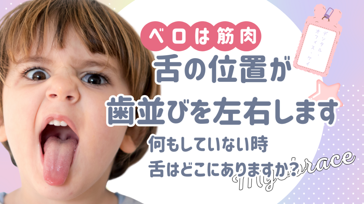 マイオブレース　岡崎市　歯科　歯科医院　歯科衛生士